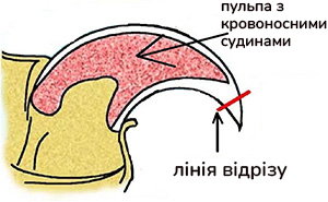 кігтерізка кігтеріз