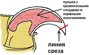 когти